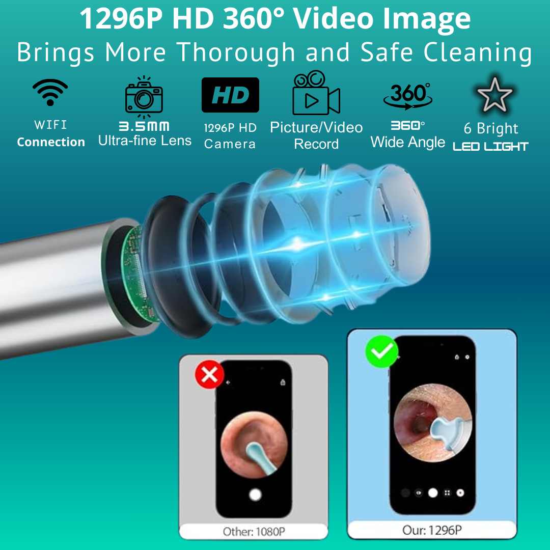 Hessovia ZenithClean Smart Visual Ear Wax Remover