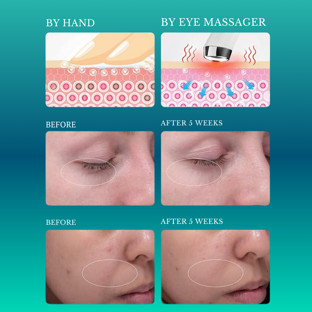 ZenithGlow Electric Eye Enhancer