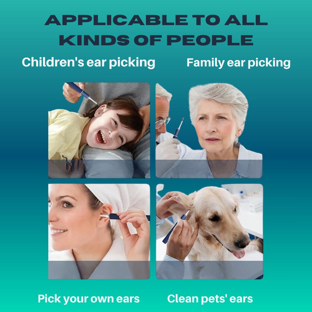 Hessovia ZenithClean Smart Visual Ear Wax Remover