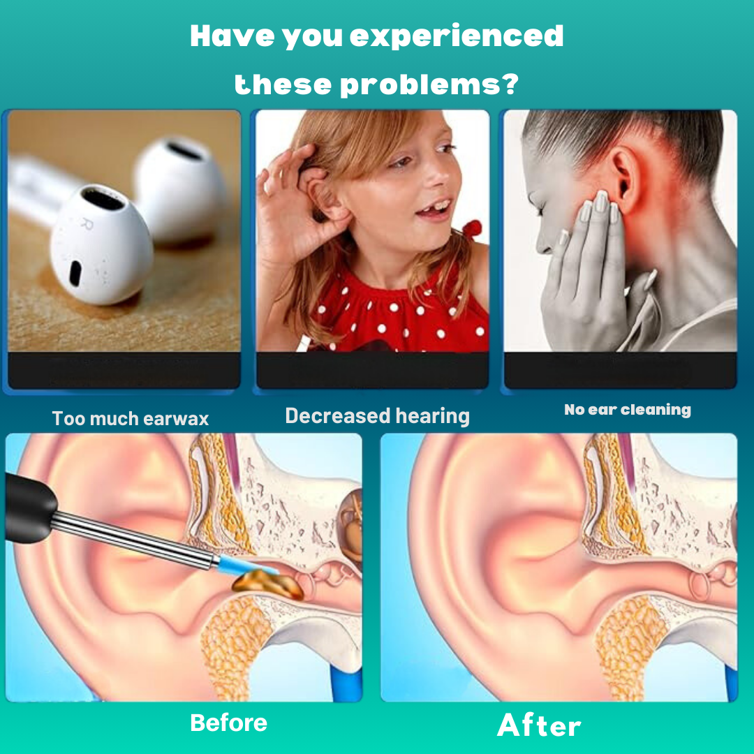 Hessovia ZenithClean Smart Visual Ear Wax Remover