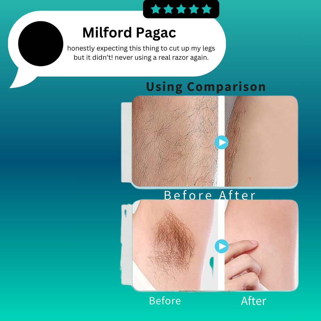 Hessovia Portable Hair Removal Device