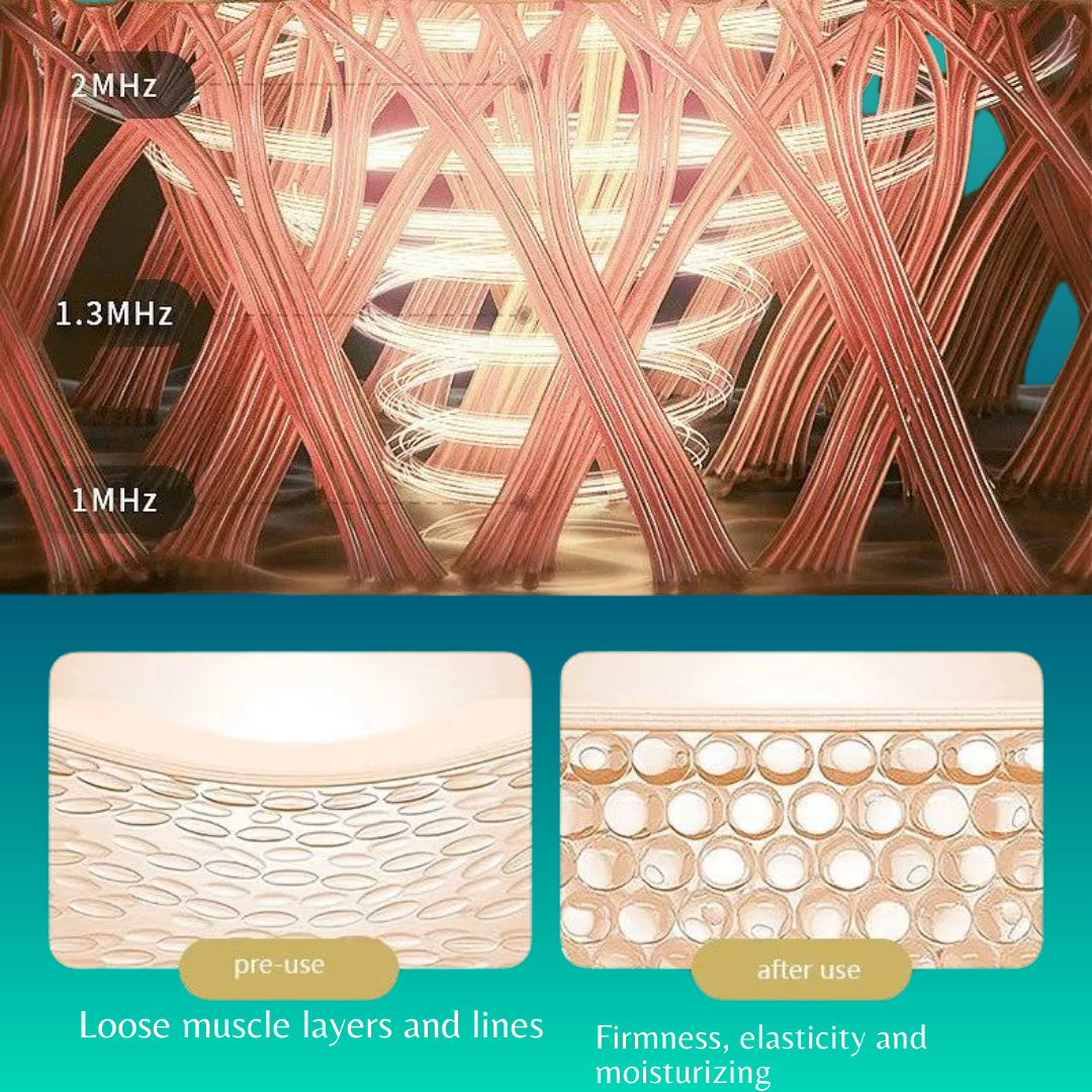 Hessovia Anti-Aging Facial Electric Massage