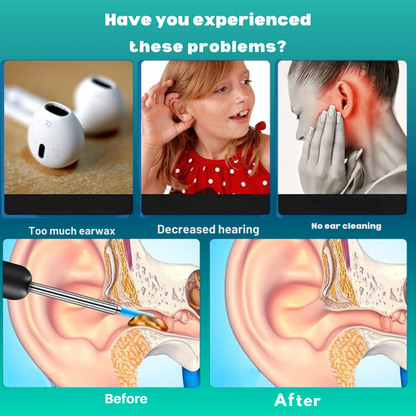 Hessovia ZenithClean Smart Visual Ear Wax Remover