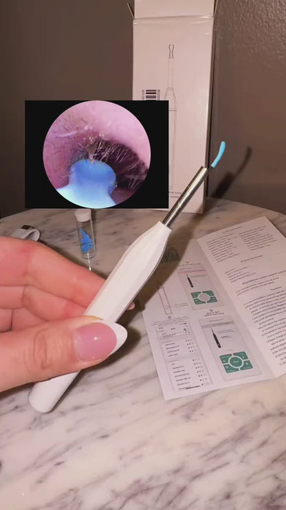 Hessovia ZenithClean Smart Visual Ear Wax Remover